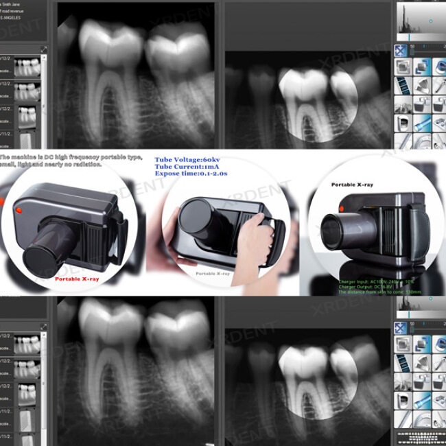 Bright Black Portable X Ray Digital Dental Radiography Machine